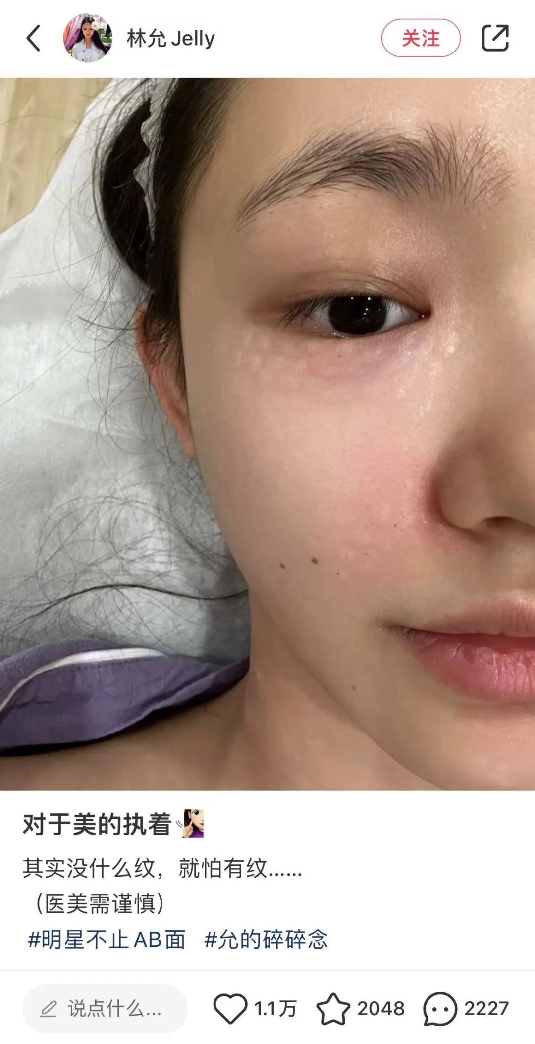 小红书“星”球崛起