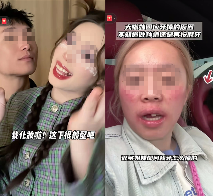 豁出去的大嘴妹用&ldquo;烂脸营销&rdquo;杀入美妆直播