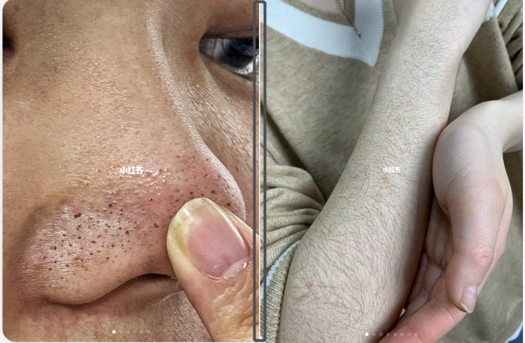 抄作业!如何提升小红书商业报备笔记的爆文率?6大标题要素;7种爆文封面;6大内容表达形式